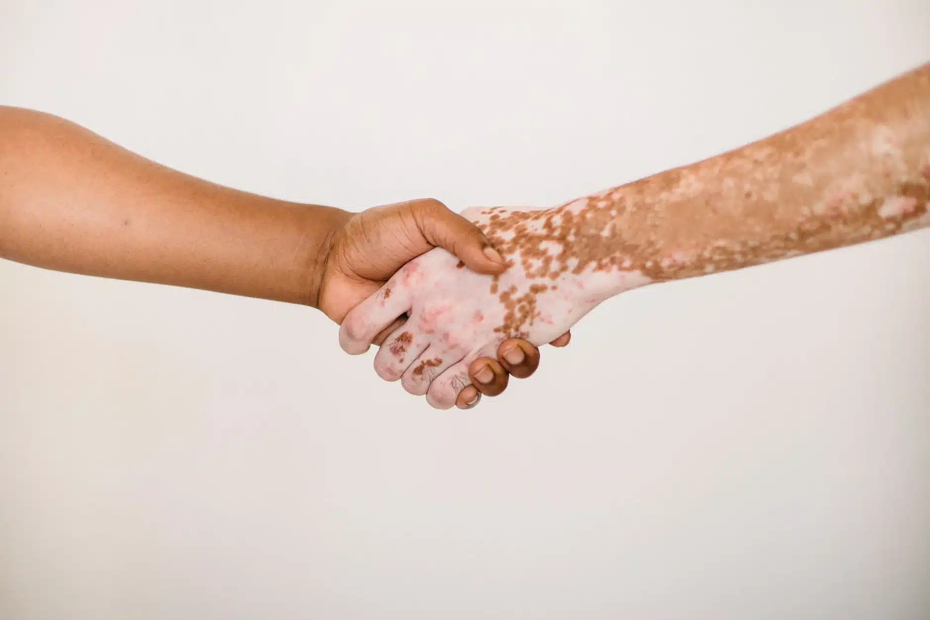 Hands handshake skin